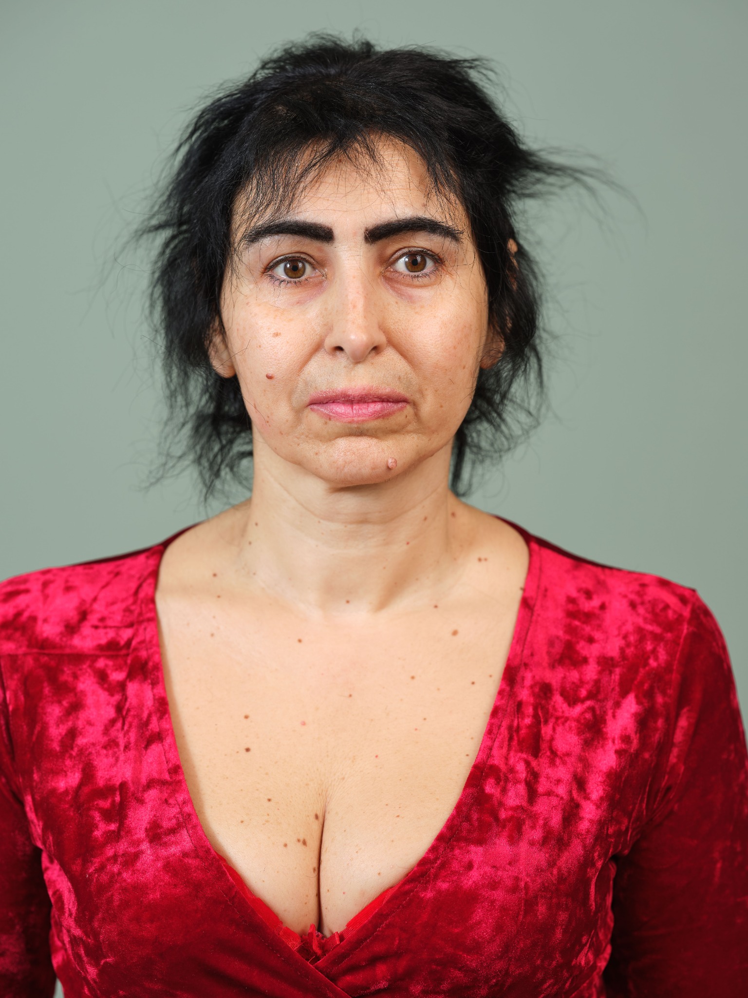 Vorher lichtes Haar Oberkopf